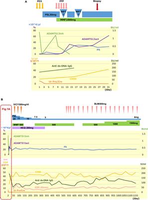 Systemic Lupus Erythematosus Presenting With Thrombotic Thrombocytopenic Purpura at Onset: A Case Report